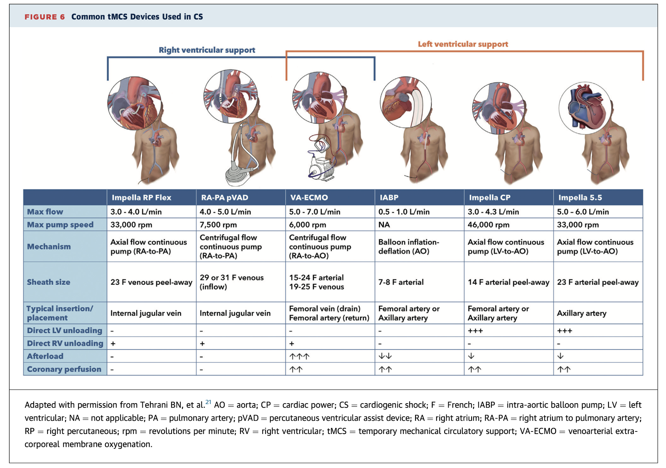 Comparação dos Dispositivos de Suporte Circulatório Mecânico