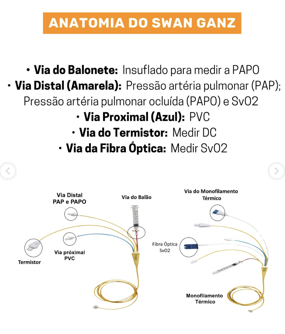 Anatomia do Swan-Ganz